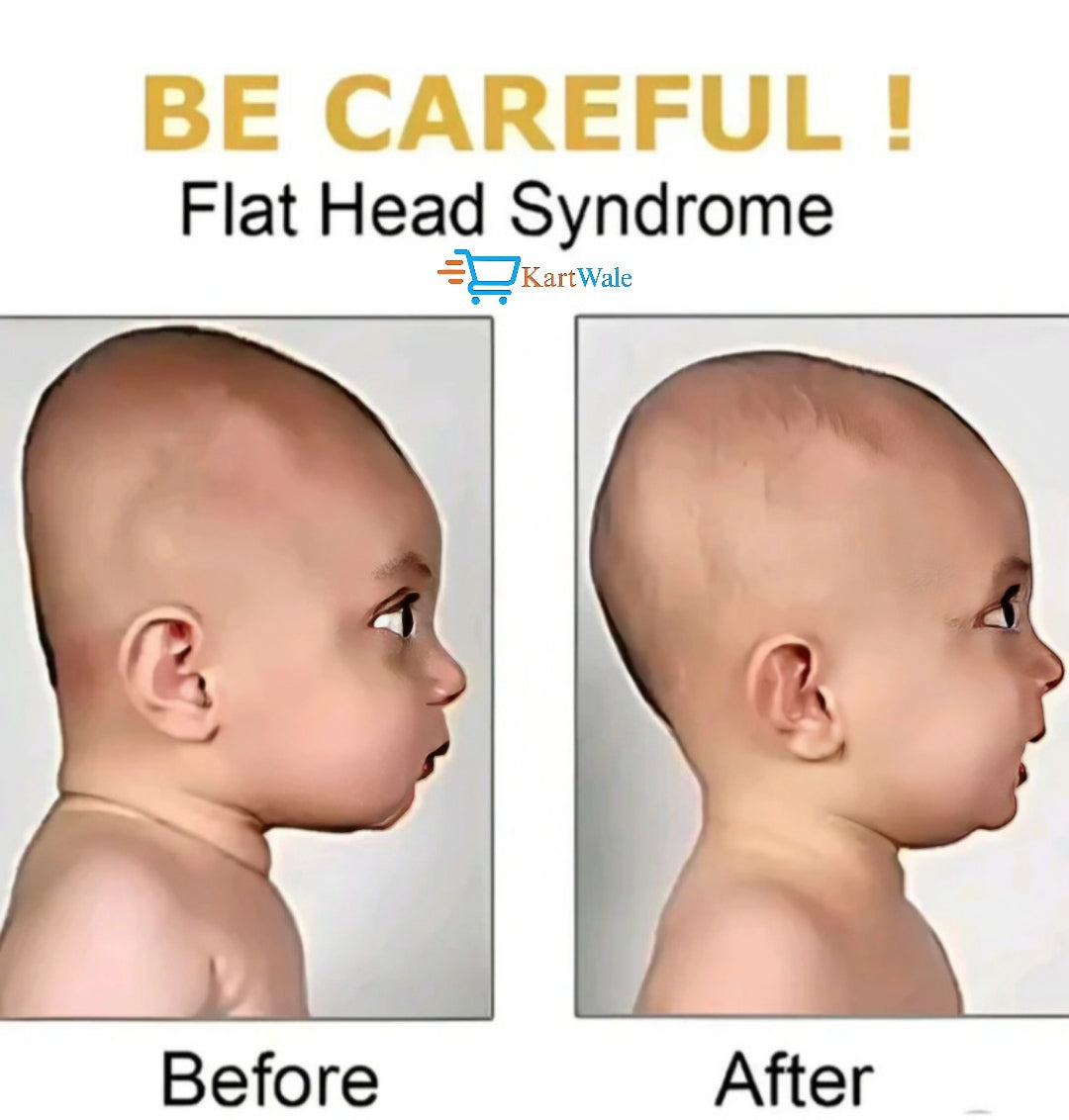 Baby Head Shaping Pillow – Soft, Breathable & Flat Head Prevention